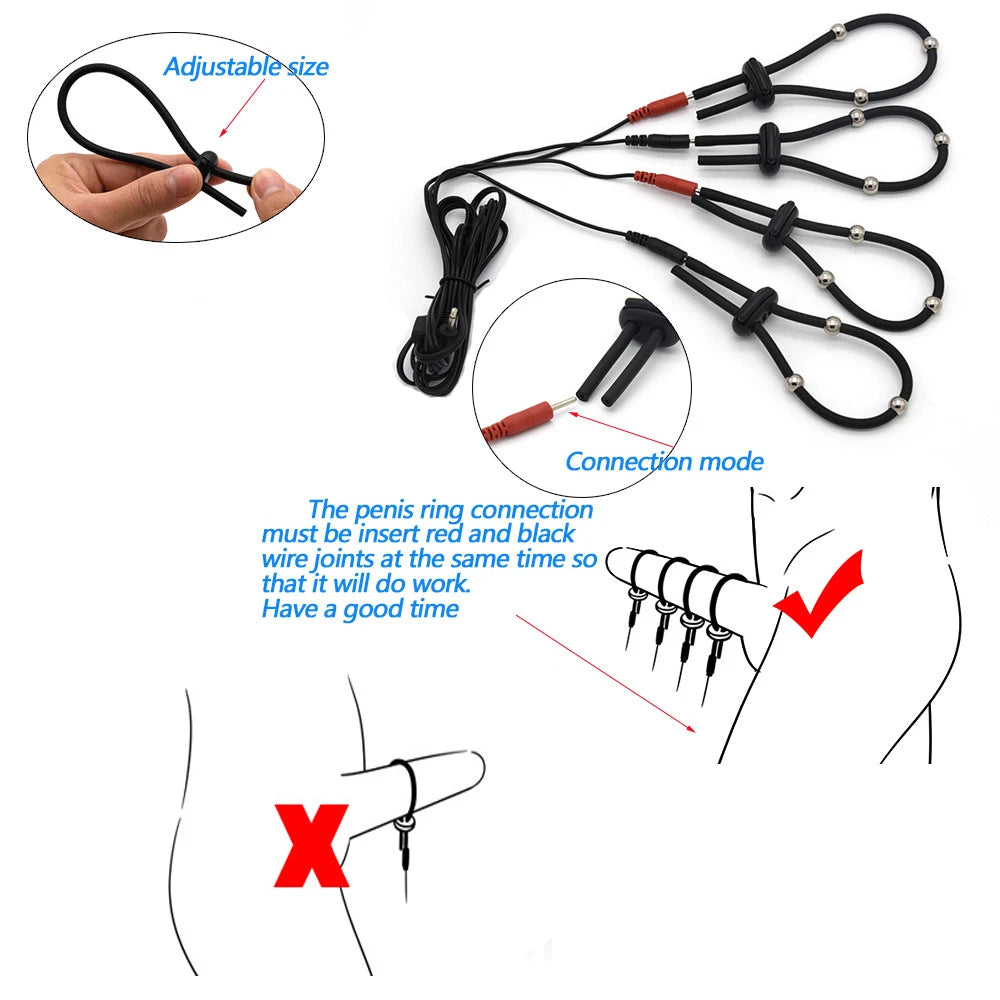 Intense Electric Shock BDSM Prostate Massage Kit